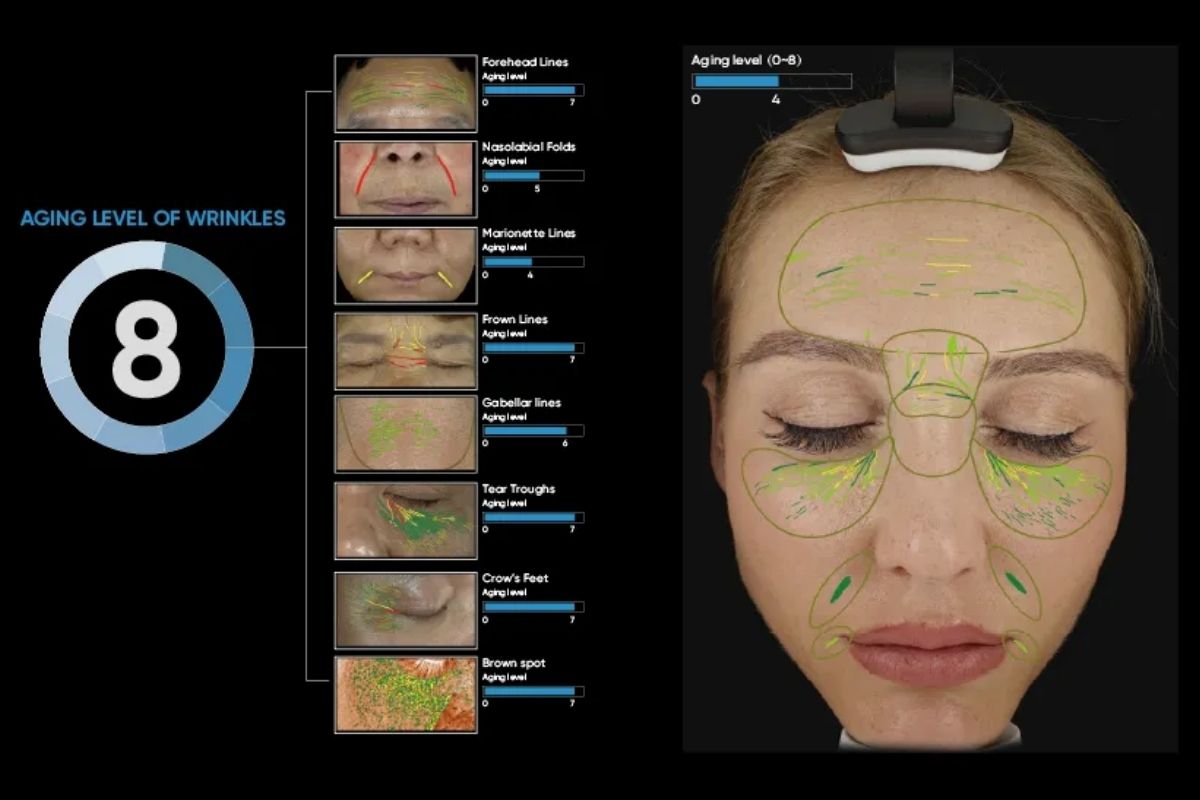 3D Skin analyzer ISEMECO 3D D9